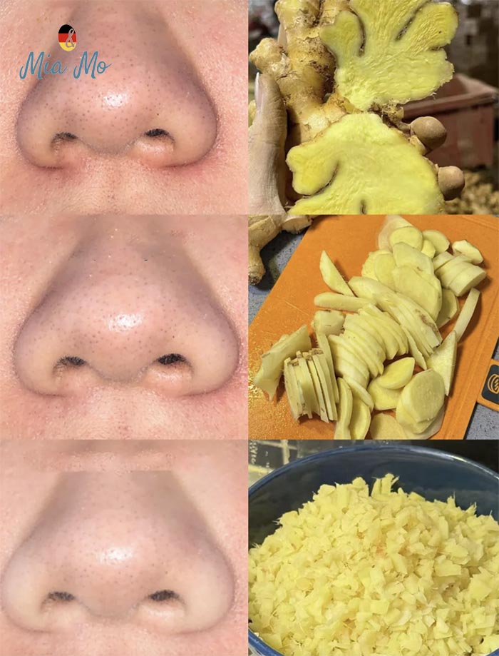xông hơi gừng